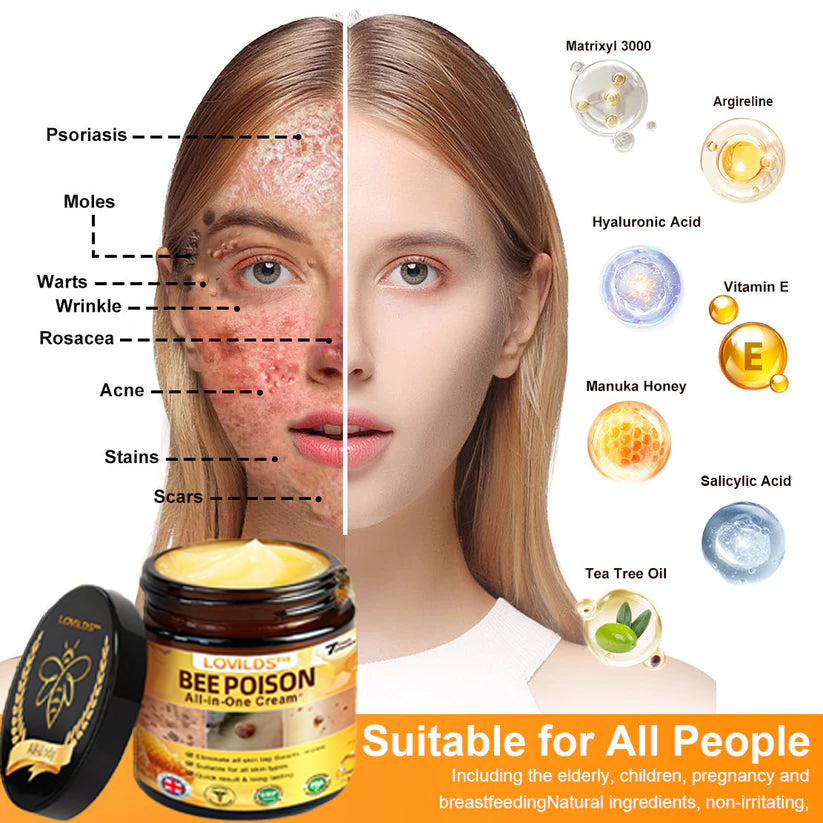 [Official Brand Store] 🐝 LOVILDS® Bee Venom All-In-One Cream (👩‍⚕️British Association of Dermatology 2025 Special Recommendation)